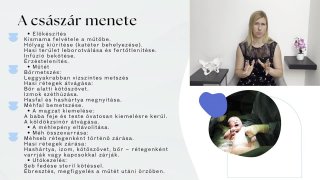 Császármetszés